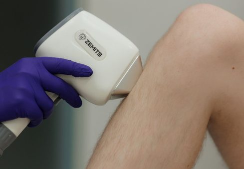 Мужская лазерная эпиляция ног